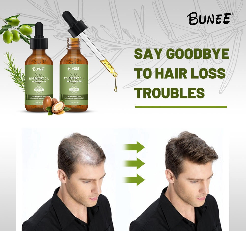 BUNEE Rosemary Hair Growth Serum Oil